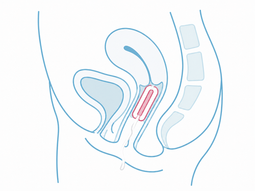 Comparison diagram showing tampon position higher in the vaginal canal versus a period cup